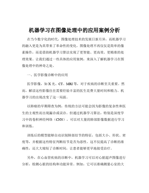 机器学习在图像处理中的应用案例分析