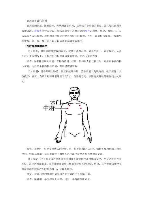 肩周炎症状拔罐穴位图