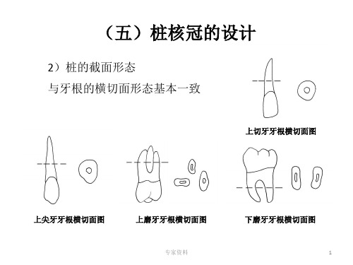 牙体缺损的修复贴面全冠粘结粘固与完成人造冠设计与选择修复后问题和处理专家专业