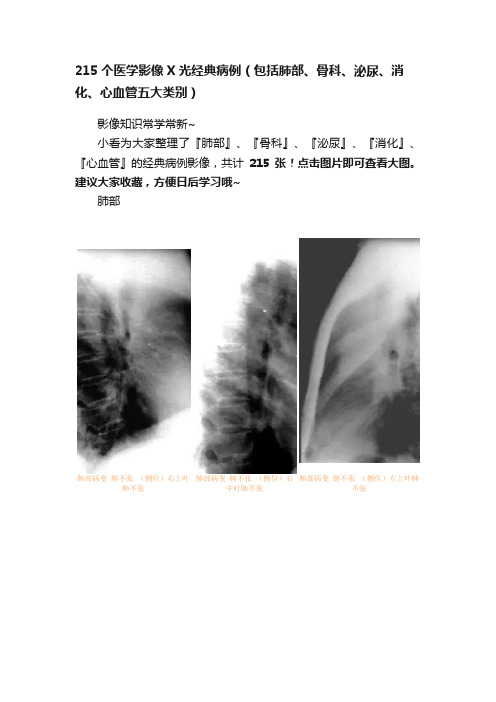 215个医学影像X光经典病例（包括肺部、骨科、泌尿、消化、心血管五大类别）