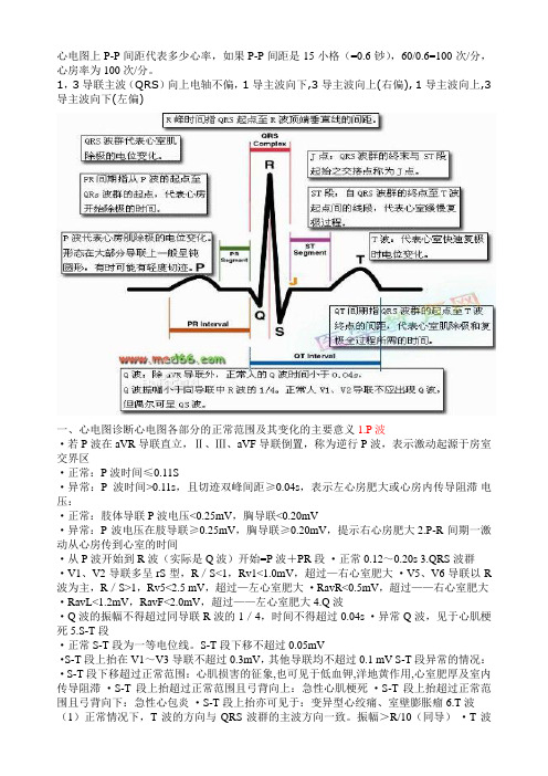 心电图讲解