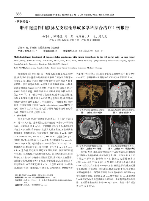 肝细胞癌伴门静脉左支癌栓形成多学科综合治疗1例报告