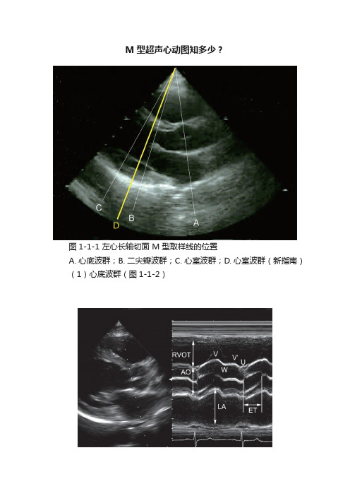 M型超声心动图知多少？