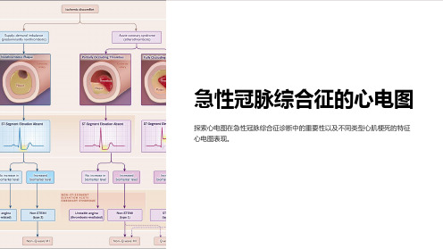 急性冠脉综合征的心电图课件