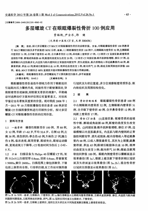 多层螺旋CT在眼眶爆裂性骨折100例应用