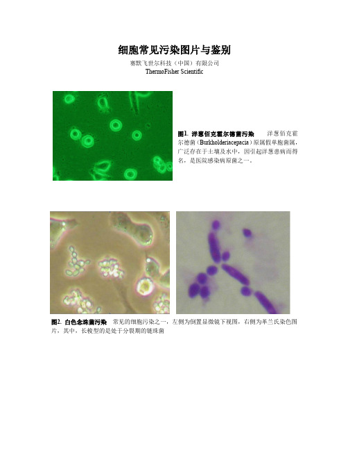 细胞常见污染图片与鉴别