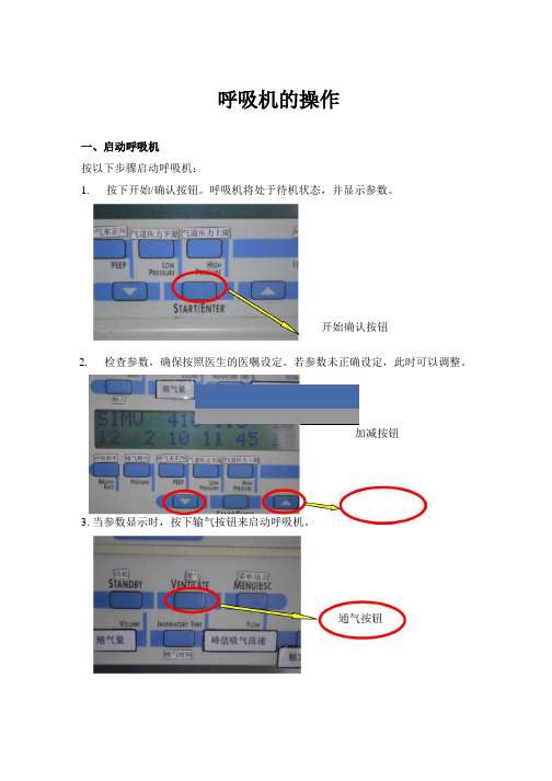 呼吸机操作流程图(图文并茂版)