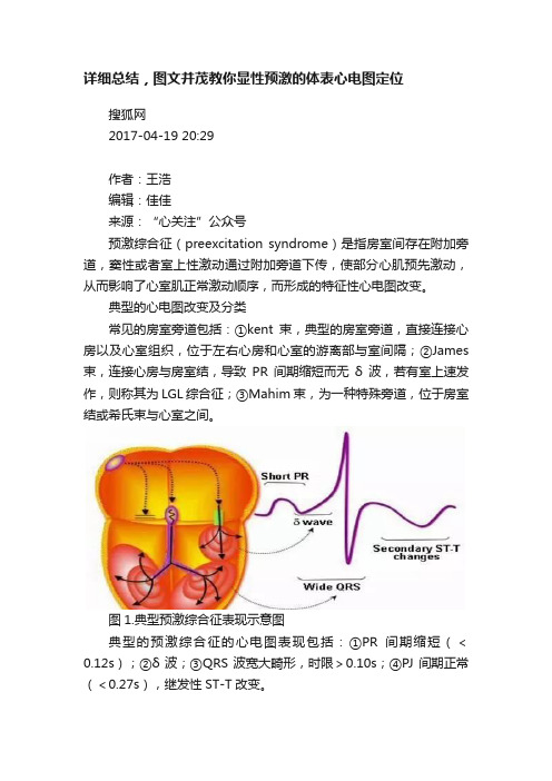 详细总结，图文并茂教你显性预激的体表心电图定位