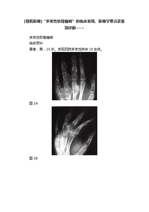 [骨肌影像]“多发性软骨瘤病”的临床表现、影像学要点及鉴别诊断~~~