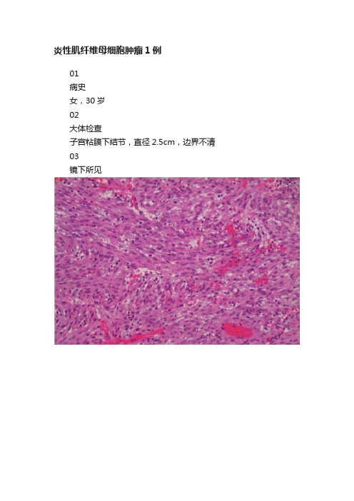 炎性肌纤维母细胞肿瘤1例