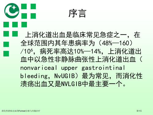 消化性溃疡出血的Forrest分级与内镜治疗