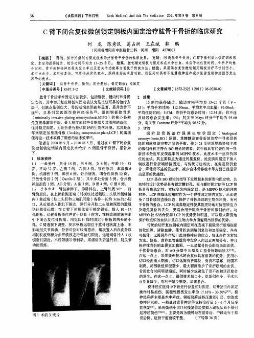 C臂下闭合复位微创锁定钢板内固定治疗肱骨干骨折的临床研究