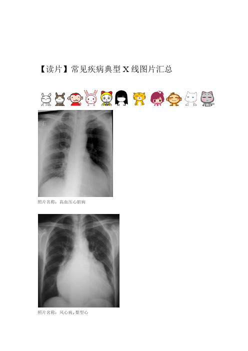 常见疾病典型X线图片汇总 