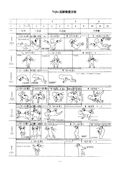 Vojta姿势反射图示