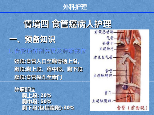 外科护理学课件——食管癌病人护理