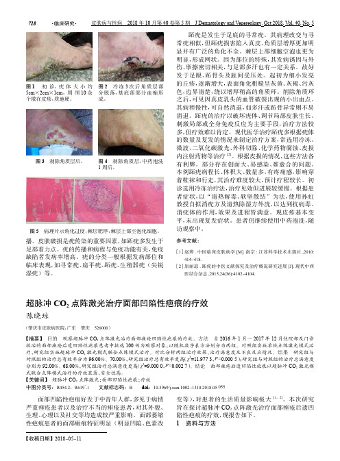 超脉冲CO2点阵激光治疗面部凹陷性疤痕的疗效