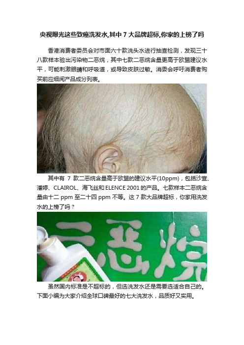 央视曝光这些致癌洗发水,其中7大品牌超标,你家的上榜了吗