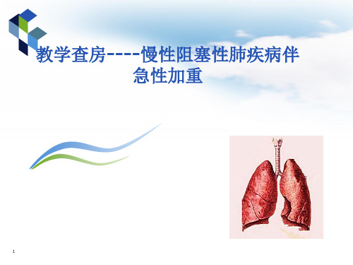 教学查房(COPD)