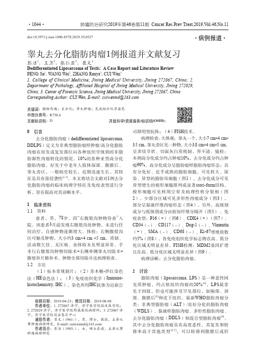 睾丸去分化脂肪肉瘤1例报道并文献复习