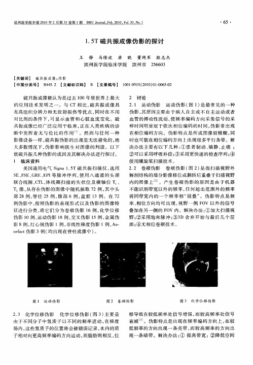 1.5T磁共振成像伪影的探讨