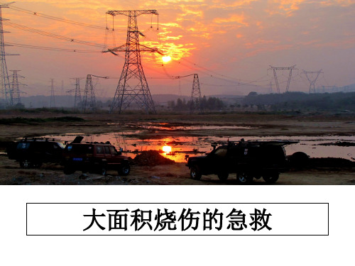 最新大面积烧伤的急救ppt课件