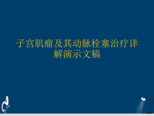 子宫肌瘤及其动脉栓塞治疗详解演示文稿