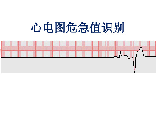 心电图危急值识别