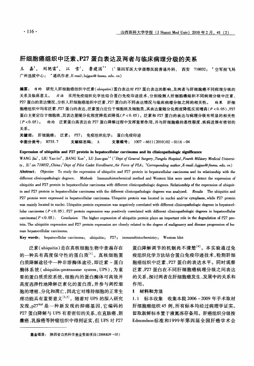 肝细胞癌组织中泛素、P27蛋白表达及两者与临床病理分级的关系