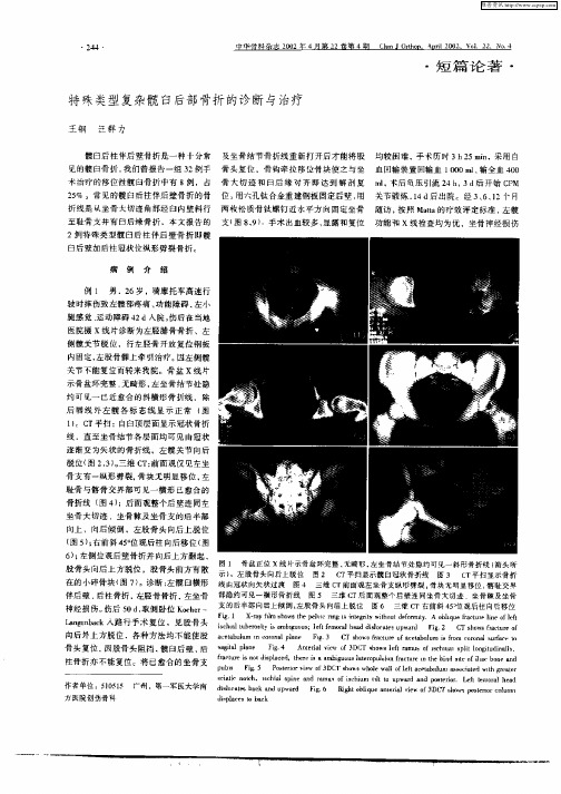 特殊类型复杂髋臼后部骨折的诊断与治疗