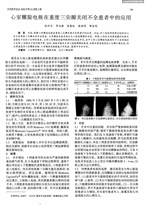 心室螺旋电极在重度三尖瓣关闭不全患者中的应用