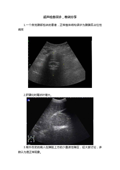 超声检查误诊，教训分享