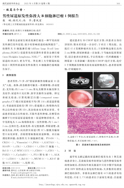 男性尿道原发性弥漫大B细胞淋巴瘤1例报告