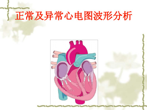 正常及异常心电图波形分析最新PPT课件