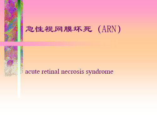 视网膜坏死幻灯