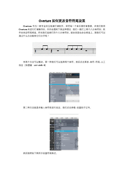 Overture如何更改音符符尾设置
