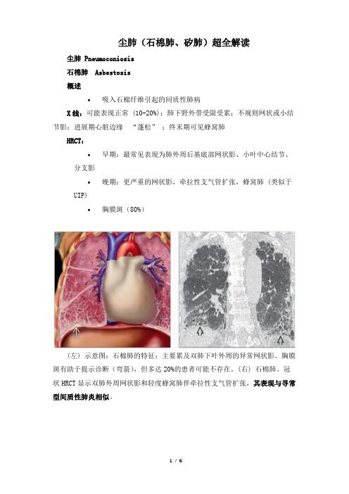 尘肺(石棉肺、矽肺)超全解读