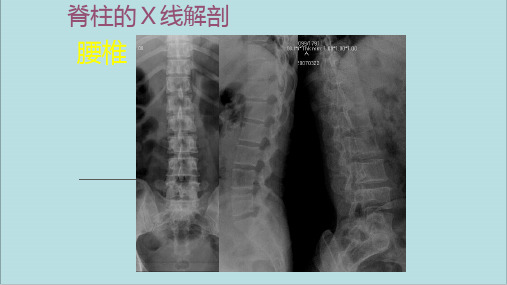 腰椎影像解剖学