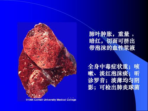 第七章 呼吸系统疾病(七年制)