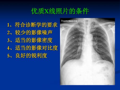 优质照片条件