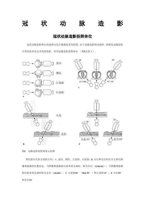 冠状动脉造影入门图解