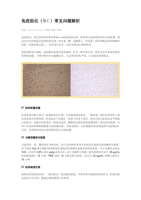 免疫组化(IHC)常见问题解析