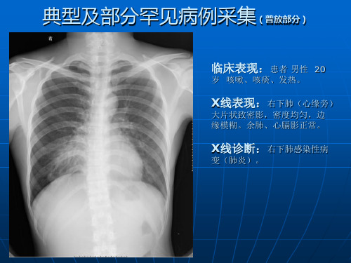 典型及部分罕见病例采集