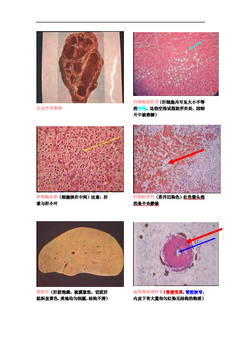 病理学图片