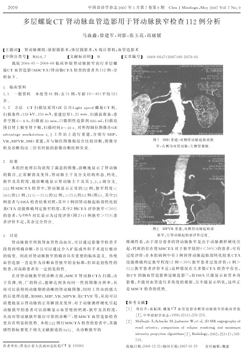 多层螺旋CT肾动脉血管造影用于肾动脉狭窄检查