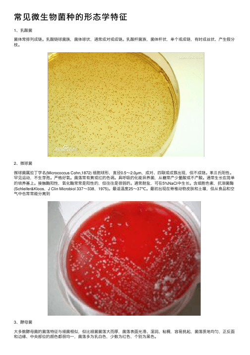 常见微生物菌种的形态学特征