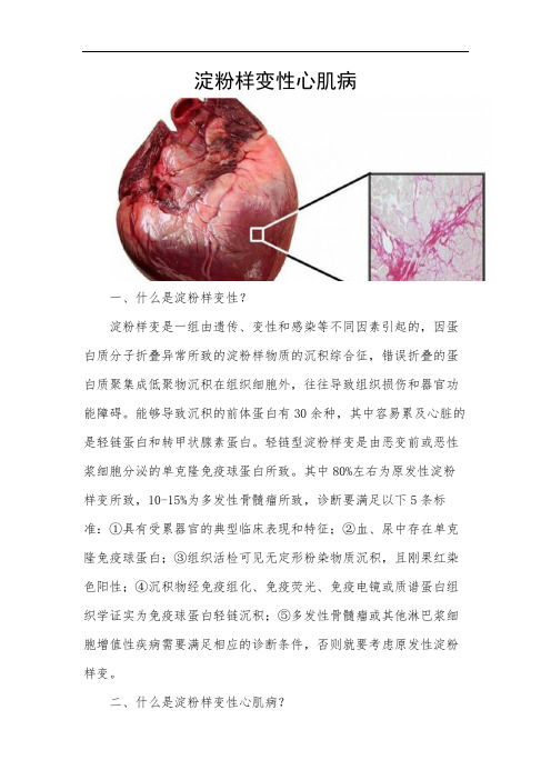 淀粉样变性心肌病