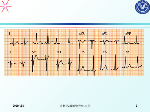 《心电图258页》ppt课件