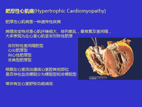 心脏超声课件：肥厚性心肌病