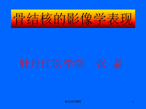 骨结核的影像学表现ppt课件