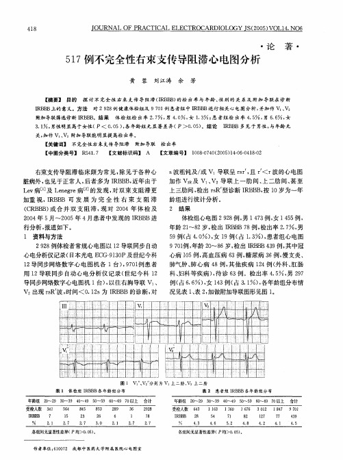 57例不完全性右束支传导阻滞心电图分析1